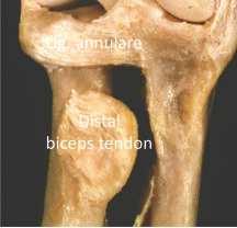 Proximalis alkar: