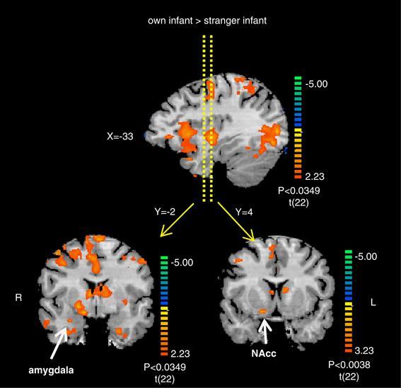 Humán szülők agyában aktiválódó agyterületek: fmri kísérletek Shir Atzil, Talma Hendler and Ruth Feldman (2011) Specifying the