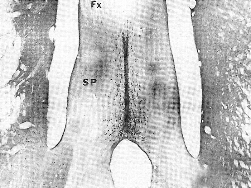 Kolinerg neuronok a