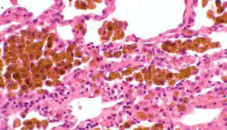 Angiogenesis: VEGF (vascular endothelial growth factor), FGF