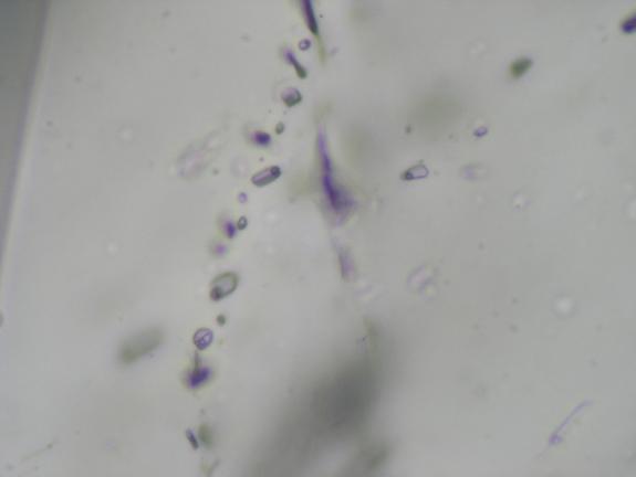 Rm-70-16) 25 µm 25 µm 3.