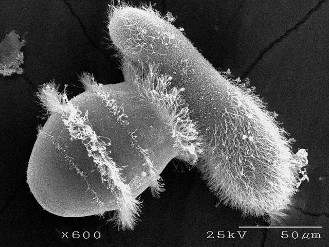 Ciliophora - Csillósok Kétféle sejtmag, teljes