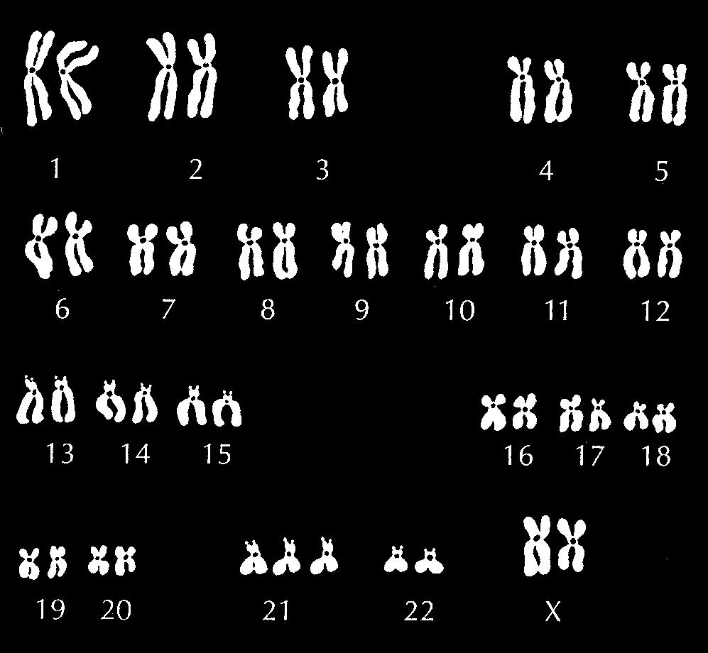 26 M041-421-2-2M VIII. MUTACIJE VIII. MUTÁCIÓK Skica prikazuje različna kariograma. Az ábra két különböző kariogramot mutat be.