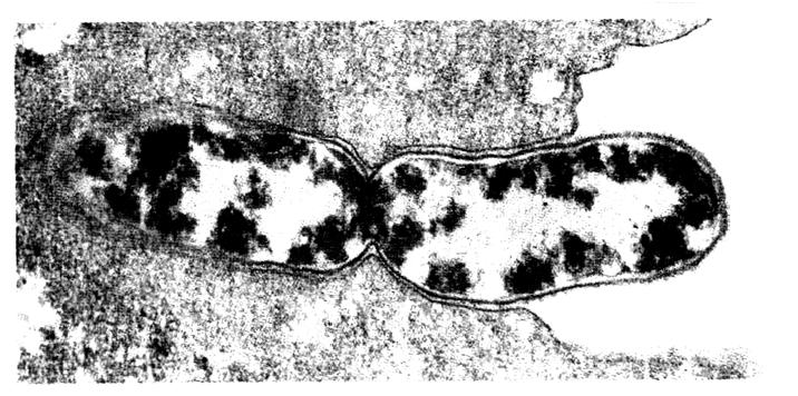 8 M041-421-2-2M II. DELITEV CELICE II. A SEJT OSZTÓDÁSA 1. Zgornja slika prikazuje bakterijo med cepitvijo. Kaj se dogaja z DNA med cepitvijo? A fenti kép a baktériumot hasadás közben mutatja be.