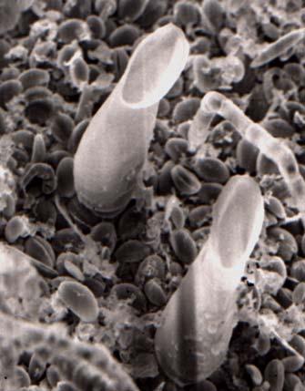 algal cells Diatom