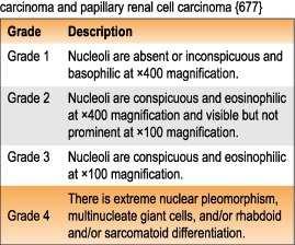 ccrcc: sejtmag paraméterek nem voltak Pg FG magas interobserver variancia ccrcc, prccok, de chrccnem G vslg/hg ISUP Vancouver 0,