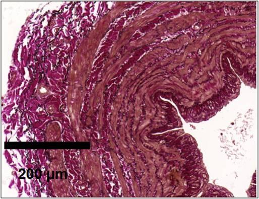 In vitro angiográfia. Két szempontos variancia analízis, non-szign. 4.2.