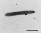 A klórozott etilének lebontásában résztvevő mikroorganizmusok l l PE l l l l l TE l DEs l l V ET Desulfitobacterium sp. strain Viet.