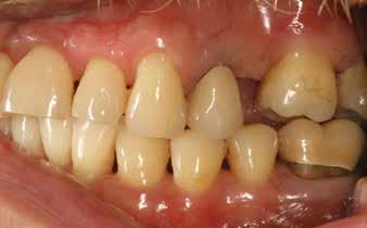 Periodontology 2000. Vol. 53, 2010, 154 166. 13. Drisko CH: Nonsurgical periodontal therapy. Periodontol 2000. 2001: 25: 77 14.
