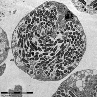 49/2015 EMMI rendelet A Legionella által okozott fertőzési kockázatról szóló EMMI rendelet vegyiparr való kiterjesztésének indokai és a vegyiparra vonatkozó követelmények Dr.