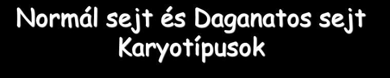 Normál