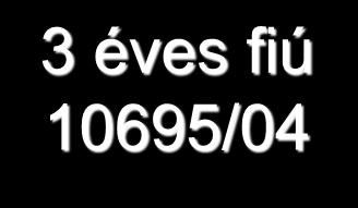 3 éves fiú 10695/04 Klinikai adatok: súlyos fokú splenomegalia, Pancytopenia Vírus szerologia:
