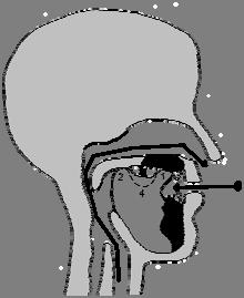 Air (approximately at atmospheric pressure) is trapped between the tongue and the roof of the mouth 4. Centre of the tongue is lowered (with a possible simultaneous sliding back of the velar closure).