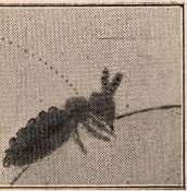 együtt más egészséges embernek vérébe oltja (1. a 8. képet). ső t van, a ki Brauer-ral ellentétben azt állítja, hogy eltérések (1. a 11., 12., 13.