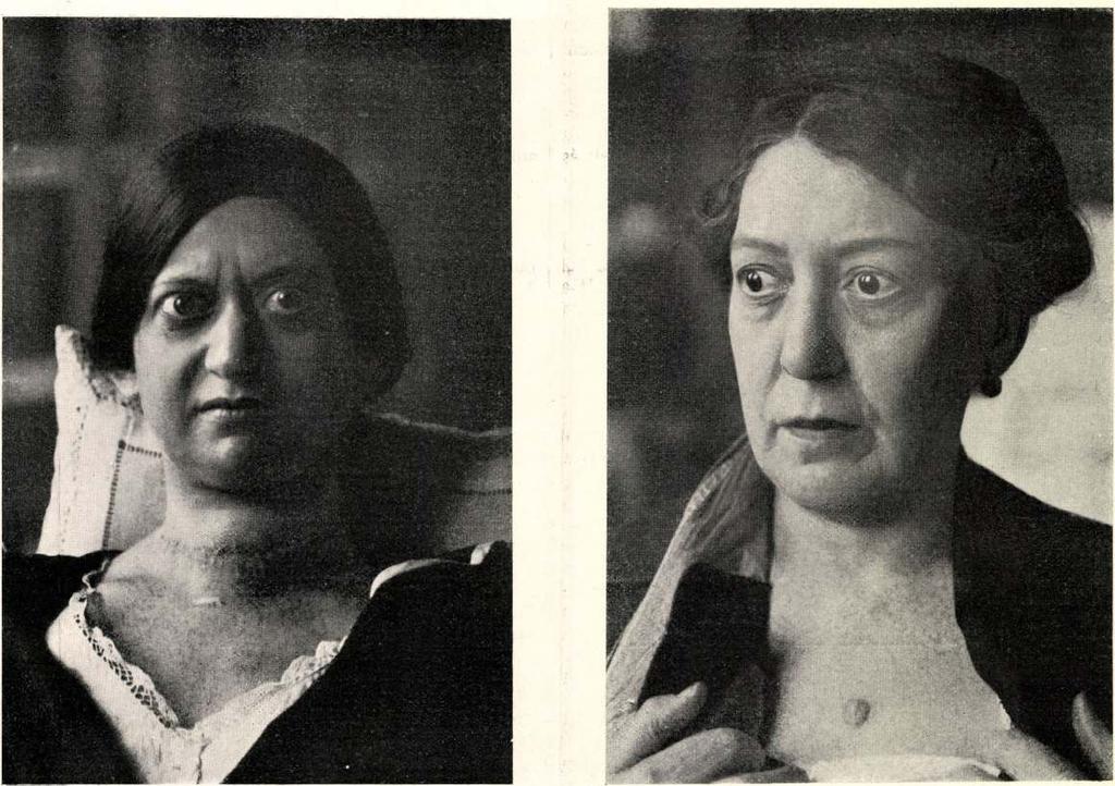 kortörténet.) 2. ábra. (45. kortörténet.) M. H.