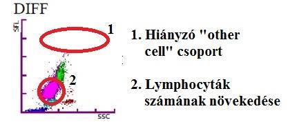 28. sz. ábra: CLL-es kutya Baso csatornán készített felhődiagramja ALL Az ALL-es megbetegedéseknél a gép részben a monocyta régióban, részben annál magasabban jelenítette meg a nagy lymphocytákat.