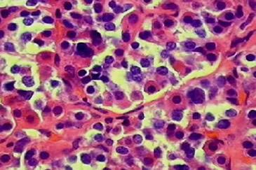 A sejtek citoplazmájában hormonnal telt granulumok.