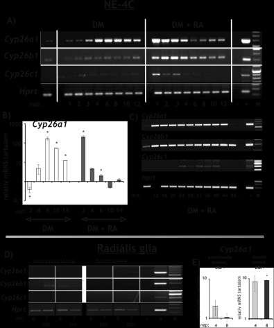34. ábra: A retinsav lebontásáért felelős enzimek (Cyp26a1, b1, c1) mrns-ének vizsgálata RT-PCR és Real-Time PCR módszerekkel, NE-4C (A-C) és radiális gliasejtekben (D-E).