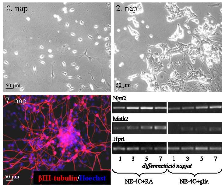 11. ábra: NE-4C idegi őssejtek neuronális differenciációja asztrogliasejtek környezetében.