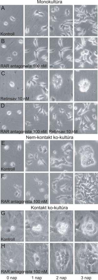 21. ábra: A retinsav szignalizáció gátlása megakadályozza az NE-4C neuroektodermális progenitor sejtek aggregátum képzését.