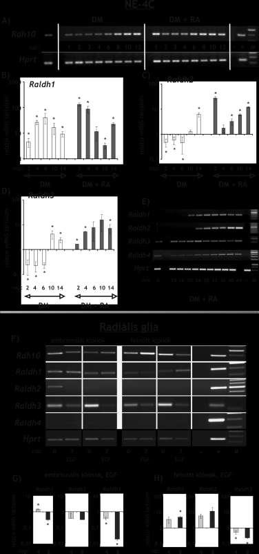 32. ábra: A retinol retinaldehiddé (Rdh10) majd a retinaldehidet retinsavvá alakításáért (Raldh 1,2,3,4) felelős enzimek mrns-ének vizsgálata RT-PCR és Real-Time PCR módszerekkel, NE-4C (A- E) és