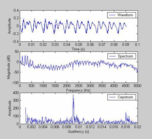 Amplitude 6. {bra: Kepsztrum egy periodikus hang esetén LPC Az alaphang periódus{t úgy is meghat{rozhatjuk, hogy maximumokat keresünk az LPC hibafüggvényében.