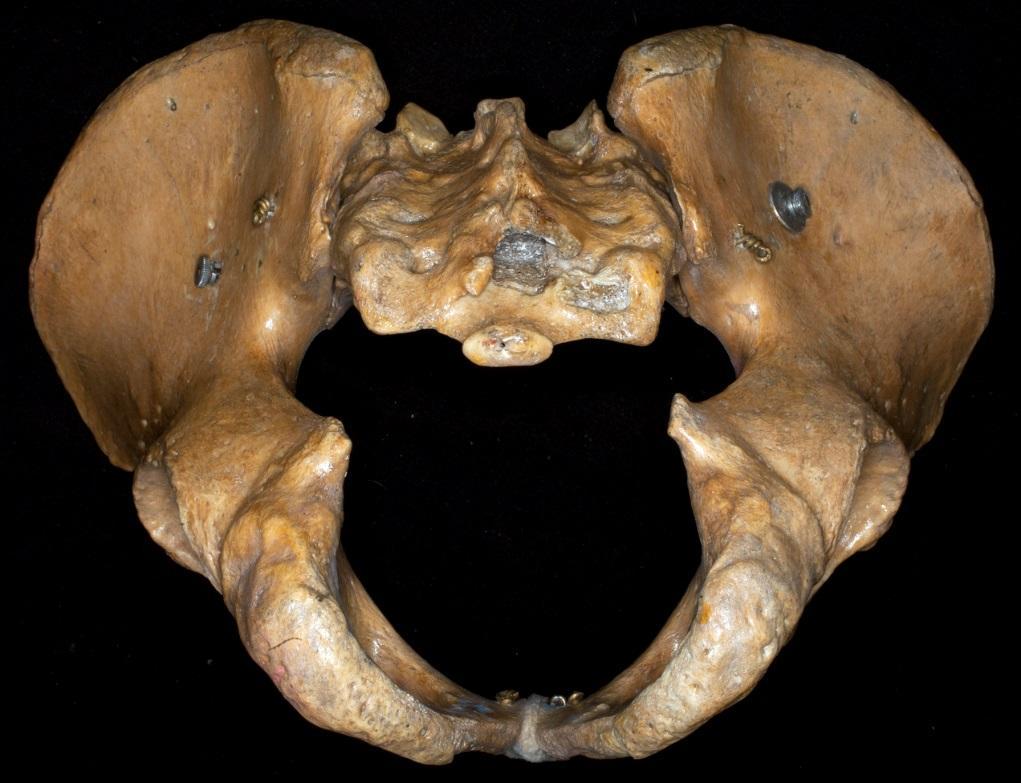 Promontorium - Articulatio sacroiliaca -