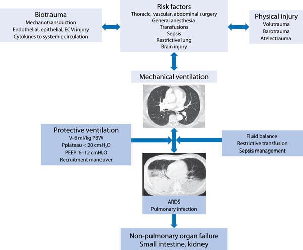Intraoperatív tüdőkárosodás kialakulása: Multiple
