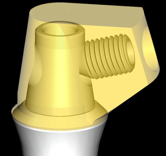 implantátum fejek: csavaros