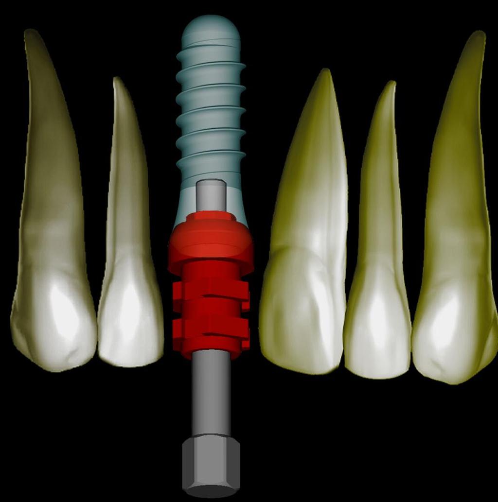 AZ IMPLANTÁCIÓS