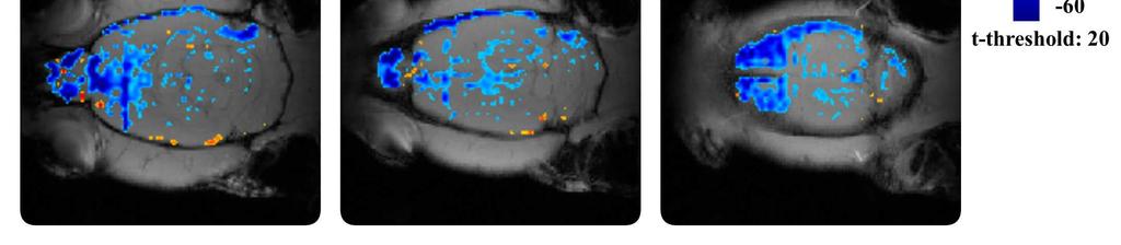 lecsengést mutatott. Önálló piracetam adás hatására a vizsgált agyterületek gyors, rövid, dózisfügg BOLD jel növekedéssel reagáltak.
