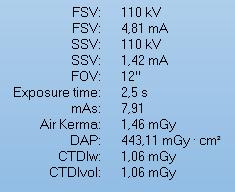 kv mas CTDIvol