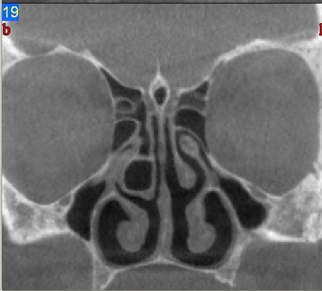 MDCT CBCT MDCT-nél jelentősen