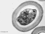 : Bacillus stearothermophilus Clostridium botulinum a k és D értékek ezekre ismertek 10 A sejteket körülvevő közeg is befolyásolja a hőpusztulást: Már enyhén savas közegben is gyorsabban pusztulnak,