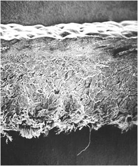 A nyersbőr szövettani felépítése Felhám (epidermis) 2-4 %: