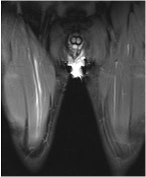rectus femoris, quadriceps izomcsoport M. gastrocnemius M.