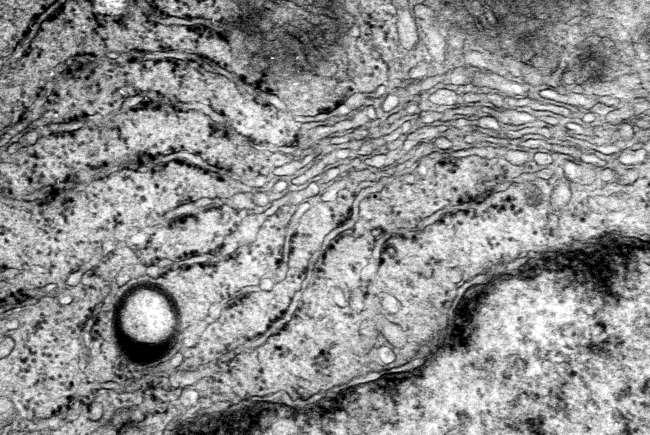 A sejtmembrán képződési helye: Az endoplasmás reticulum (ER) Szerkezete: csőszerű és lapos zsákszerű elemek (tubulusok ill. cisternák) egymással összefüggő rendszere a cytoplasmában.