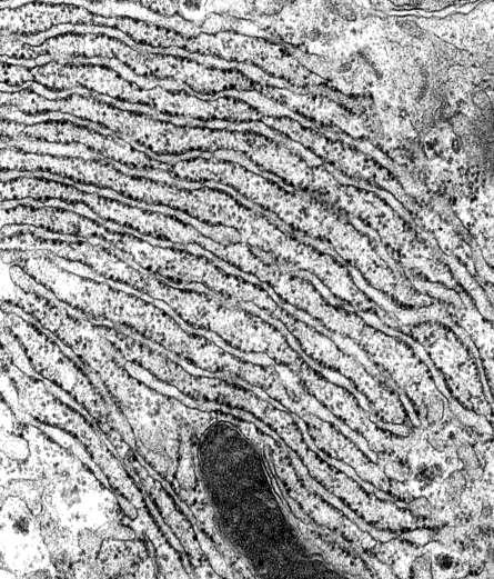 A durva felszínű endoplasmás reticulum (der) Kevésbé