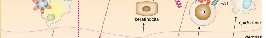 dermatitisz