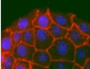 Differenciáció HepG2 HepG2 78 HepG2 78 HepG2 HepG2 78 Hep3B 78 Hep3B 78 albumin asyaloglycoprotein Claudin-1 A Hep3B esetén a jelenség diffúz volt, az eredeti