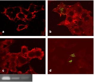 ábra: Matrilysin immuncitokémia: a:egfp, b:full, c:77, d:78-as transzfektáns.