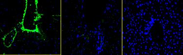 A. vad Dec -/- Dec -/- /TGF- B. vad Dec -/- Dec -/- /TGF- 6. ábra. A genetikai módosítások fehérje szinten való vizsgálata immunhisztokémiával (fluoreszcens mikroszkóp).