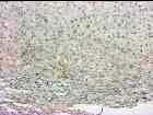 tumor#/máj 2 1,5 1,5 2,21,75,54,33,31 BL6 BCBA DecKO TGFß1 Kettős 14. ábra.
