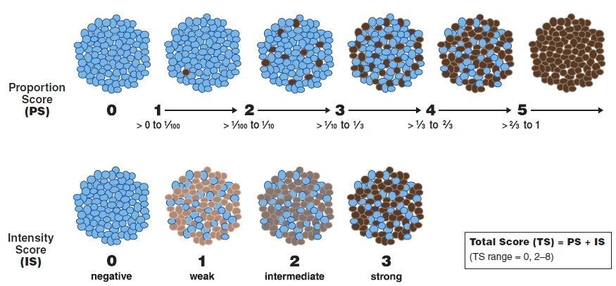 A magi hormonreceptorok (ösztrogén és progeszteron) immunreakcióinak értékelésére nemzetközileg elfogadott módszer az Allred féle Quick Index (AQI) (35) (8.Ábra). 8.