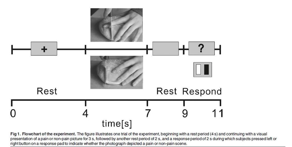 Pain Catastrophising Affects Cortical Responses to Viewing Pain in Others (Fallon et al.