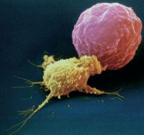 NATURAL KILLER (NK) SEJTEK Lyymphoid eredetűek Citoplazmájukban granulumok (Large Granular Lymphocyte) Az NK sejtek legfőbb jellegzetessége, hogy MHC