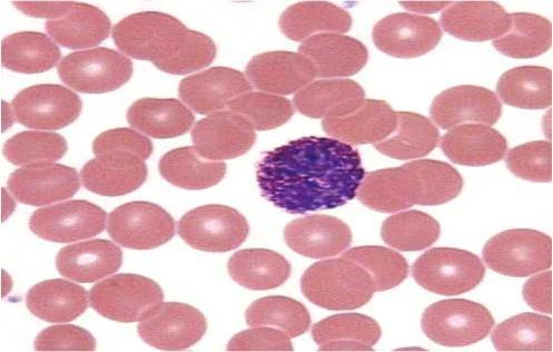 BASOPHIL GRANULOCYTÁK A basophil granulocyták a vérben fordulnak elő és strukturális, valamint funkcionális hasonlóságot mutatnak a hízósejtekkel.