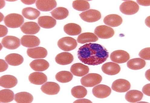 EOSINOPHIL GRANULOCYTÁK Az eosinophil granulocyták olyan granulomokkal rendelkeznek, melyek tartalma a férgek számára valamint a gazdaszervezet szöveteire károsak.