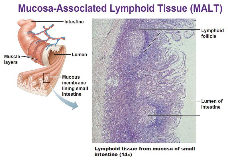 MUCOSA-ASSOCIATED LYMPHOID TISSUE (MALT) A MALT a szervezet különböző pontjain kis mennyiségben jelenlevő lymphogén szövetek diffúz rendszere (emésztőtraktus, pajzsmirigy, mell, tüdő, nyálmirigyek,