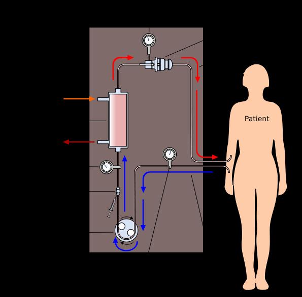Extrakorporális immunmodulációs próbálkozások Blood processing